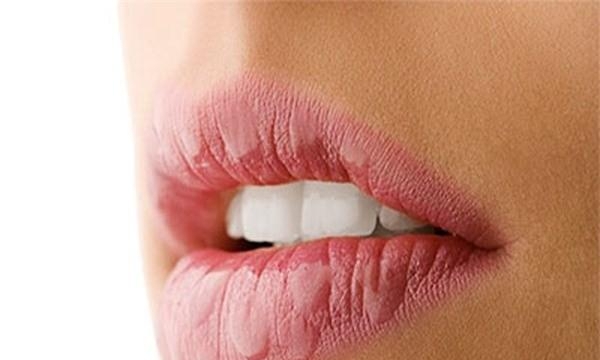 Những dấu hiệu bệnh tật thể hiện qua đôi môi của bạn
